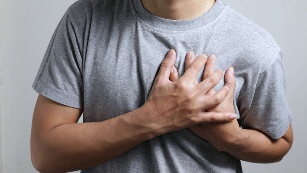 Fibrillazione atriale