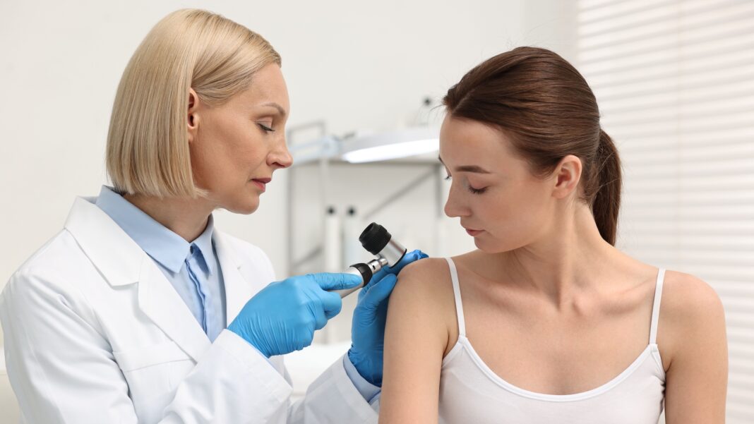 Campagna prevenzione melanoma